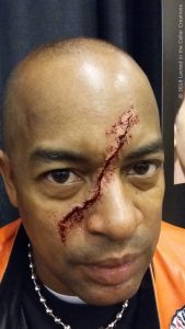 A gnarly, jagged cut right through the middle of our customer's face