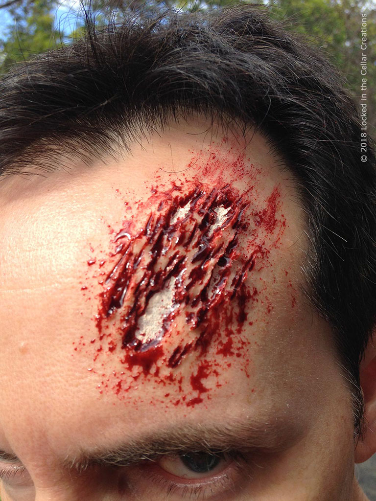 Scraped open forehead injury, showing the bone. SFX make-up using scar wax, Reel Blood and pale cream make-up.